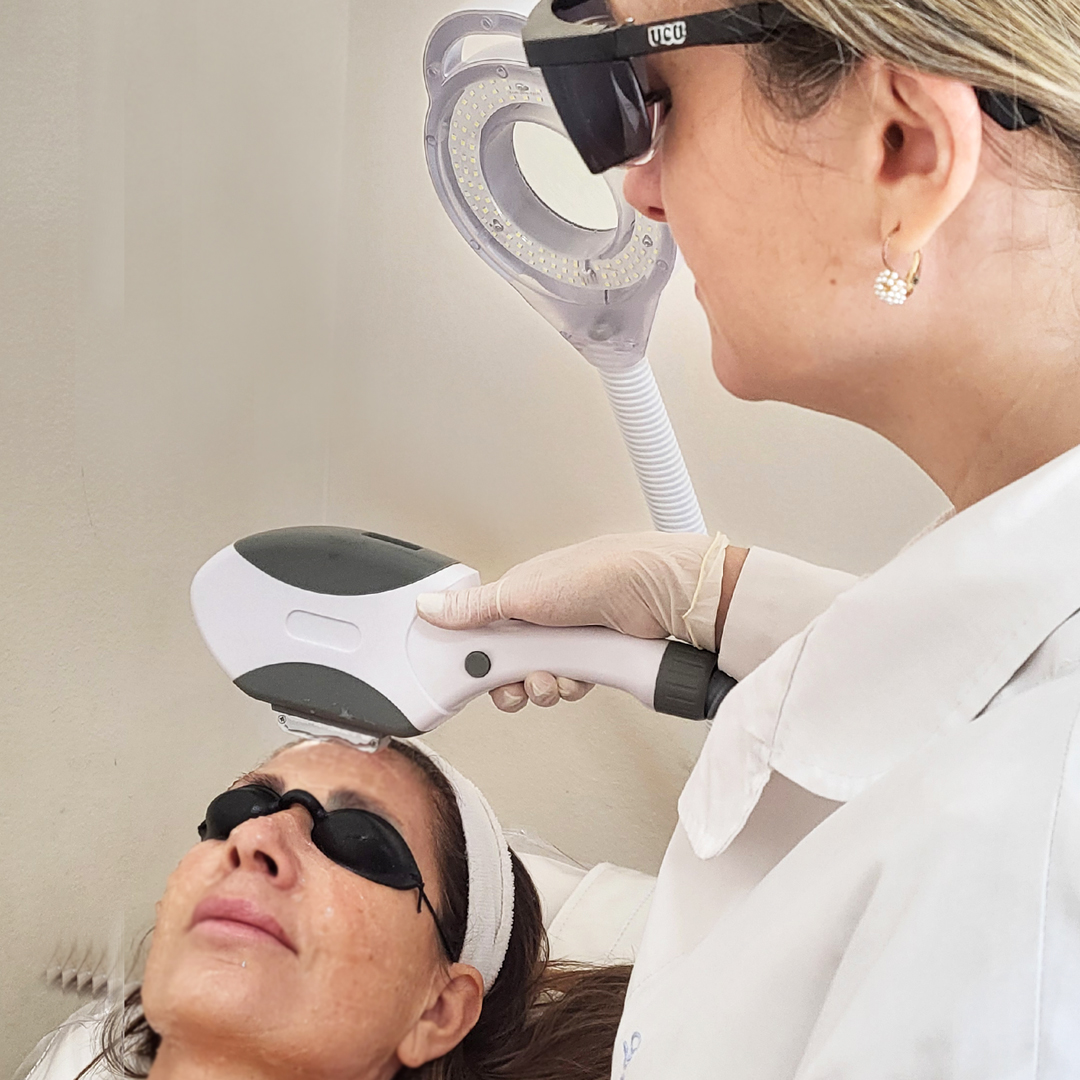 Tratamientos Faciales