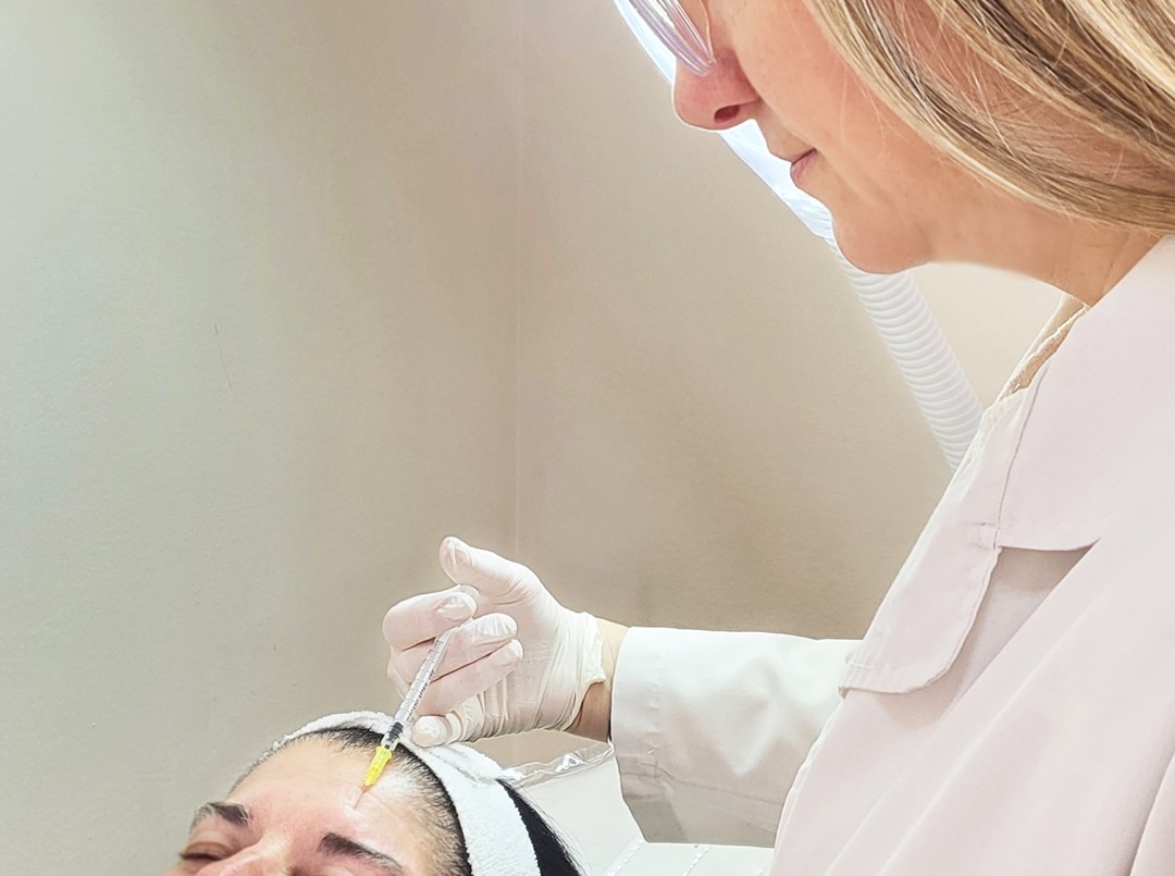 Recuperación Capilar